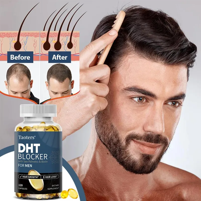 DHT Blockers for Men - with Saw Palmetto & Biotin Promote Natural Hair Growth Increase Vitality and Maximize Absorption