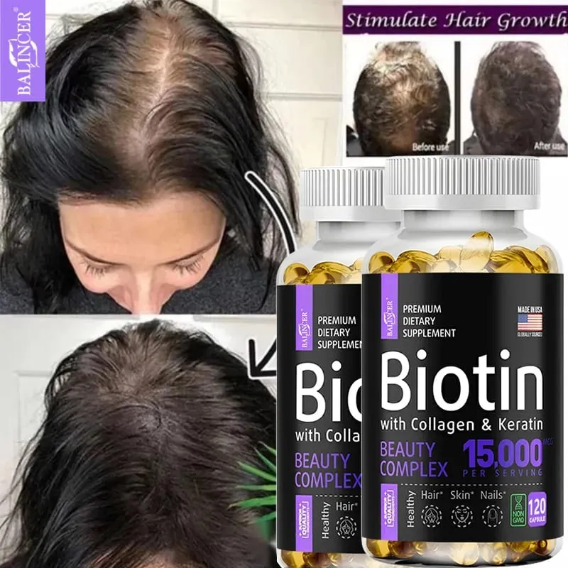 Biotin Capsules 15 000 MCG - Increase Healthier Shinier Hair Skin & Nails- 30 To 120 Capsules with Biotin Collagen A & B