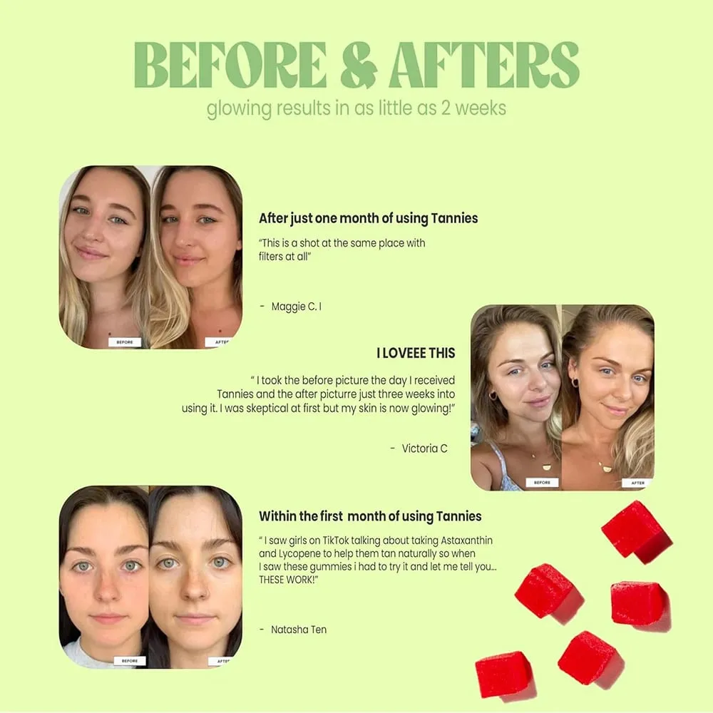 Gomas de bronzeamento - Suplemento de bronzeamento natural com astaxantina, licopeno e beta-caroteno - aumenta a melanina para uma pele radiante e com brilho